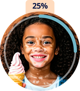circulo_vitiligo_04